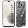 Husa pentru Honor 400 Lite, Techsuit, SparkleSkin, Transparenta